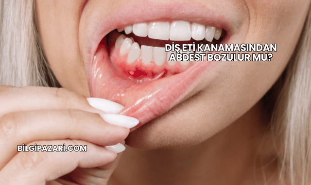 Diş Eti Kanamasından Abdest Bozulur mu?