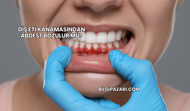 Diş Eti Kanamasından Abdest Bozulur mu?