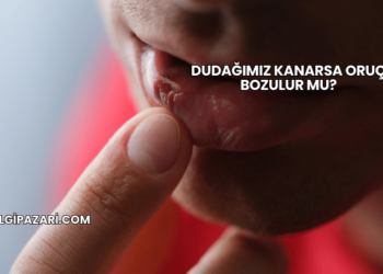 Dudağımız Kanarsa Oruç Bozulur mu?