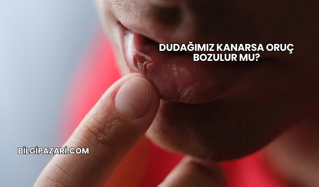 Dudağımız Kanarsa Oruç Bozulur mu?