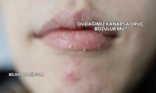 Dudağımız Kanarsa Oruç Bozulur mu?