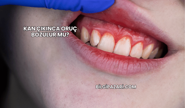 Kan Çıkınca Oruç Bozulur mu?