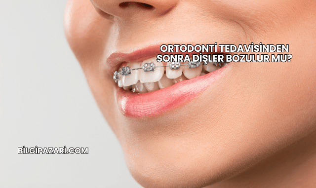 Ortodonti Tedavisinden Sonra Dişler Bozulur mu?