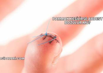 Parmak Kesilirse Abdest Bozulur mu?