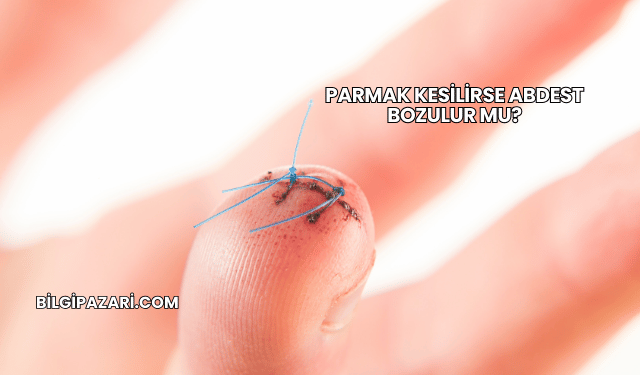 Parmak Kesilirse Abdest Bozulur mu?