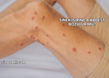 Sinek Isırınca Abdest Bozulur mu?