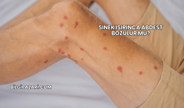 Sinek Isırınca Abdest Bozulur mu?