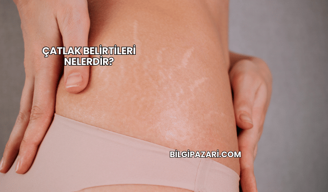 Çatlak Belirtileri Nelerdir?