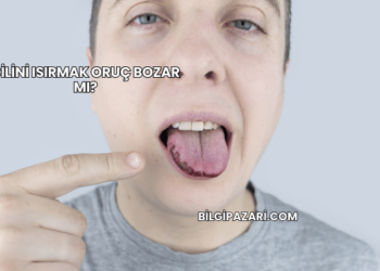 Dilini Isırmak Oruç Bozar mı?