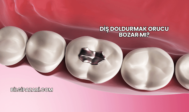 Diş Doldurmak Orucu Bozar mı?