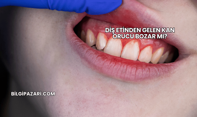 Diş Etinden Gelen Kan Orucu Bozar mı?