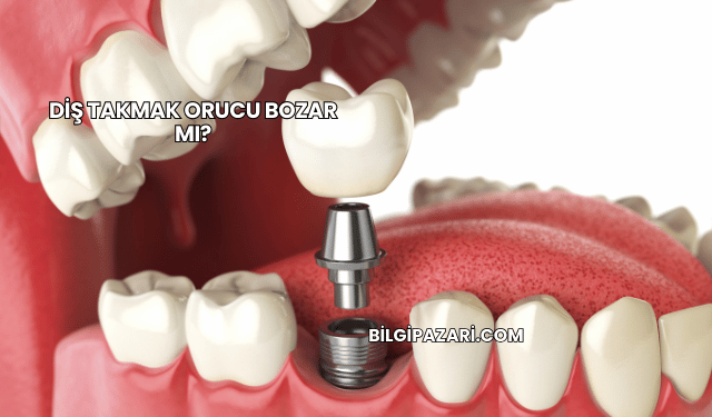 Diş Takmak Orucu Bozar mı?