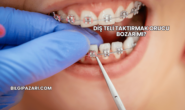 Diş Teli Taktırmak Orucu Bozar mı?