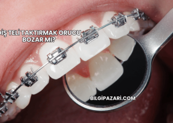 Diş Teli Taktırmak Orucu Bozar mı?