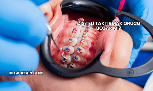 Diş Teli Taktırmak Orucu Bozar mı?