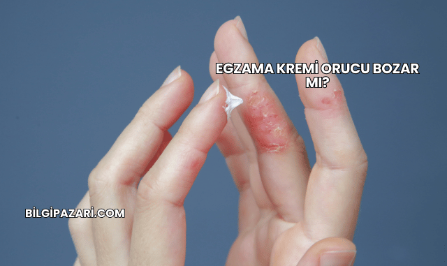 Egzama Kremi Orucu Bozar mı?