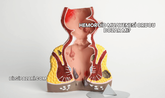 Hemoroid Muayenesi Orucu Bozar mı?