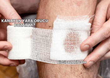 Kanayan Yara Orucu Bozar mı?