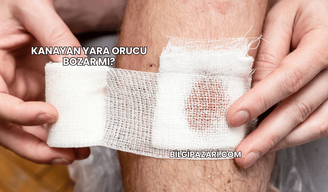 Kanayan Yara Orucu Bozar mı?