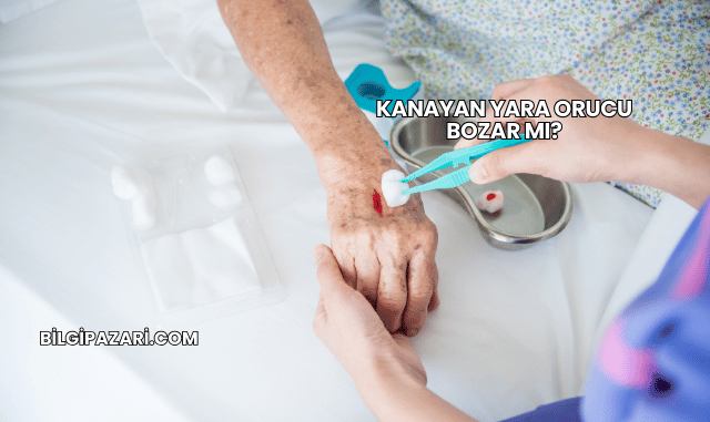 Kanayan Yara Orucu Bozar mı?