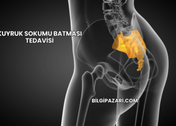 Kuyruk Sokumu Batması Tedavisi