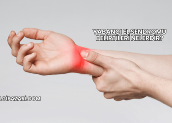 Yabancı El Sendromu Belirtileri Nelerdir?