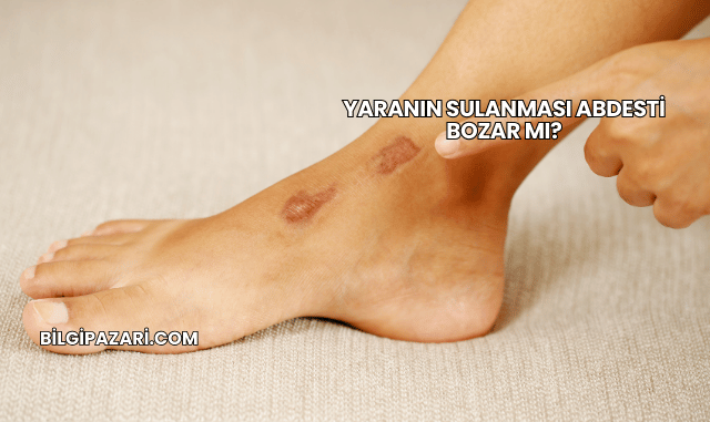 Yaranın Sulanması Abdesti Bozar mı?