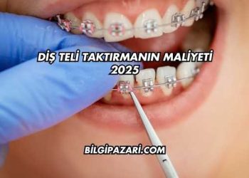 Diş Teli Taktırmanın Maliyeti 2025