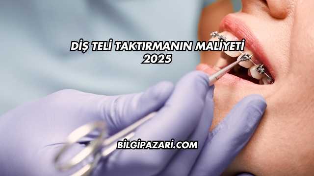 Diş Teli Taktırmanın Maliyeti 2025