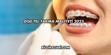 Dişe Tel Takma Maliyeti 2025