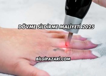 Dövme Sildirme Maliyeti 2025